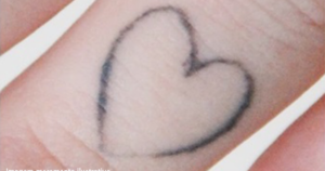 Traço de tatuagem estourado