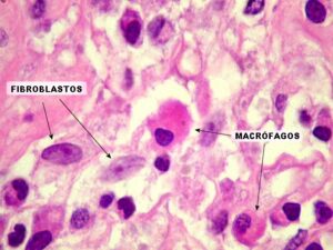 O que são os Macrófagos