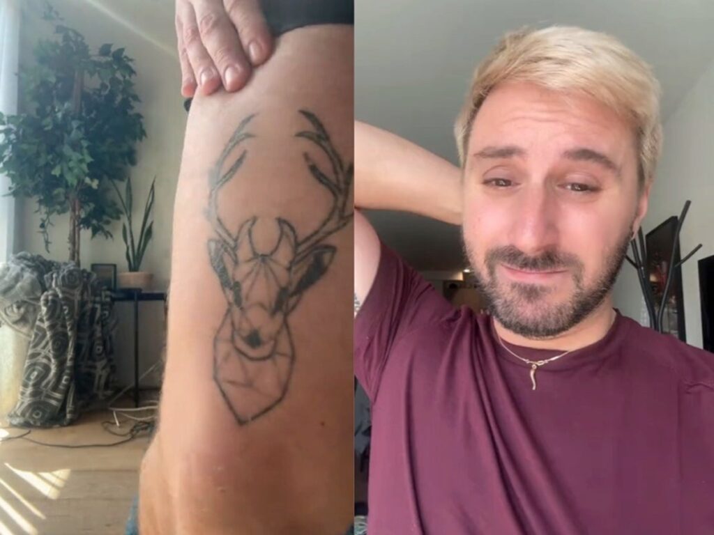 Ephemeral: Tinta de Tatuagem Que Prometia Desaparecer Decepciona Clientes Tatuagem não sumiu sozinha