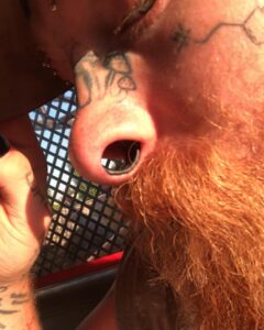 Maior septo alargado do mundo