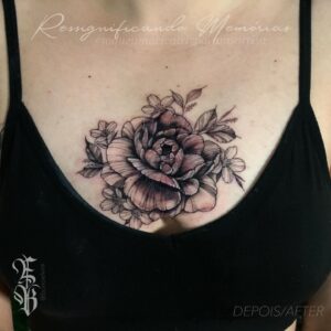 Tatuagem em cima de cicatriz