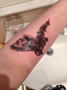 Tattoo inflamada