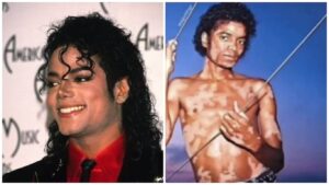 Vitiligo e Tatuagem Michael Jackson