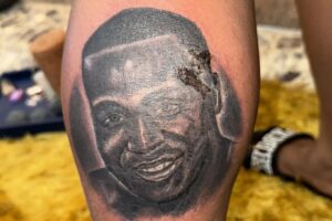 Tatuagem infeccionada